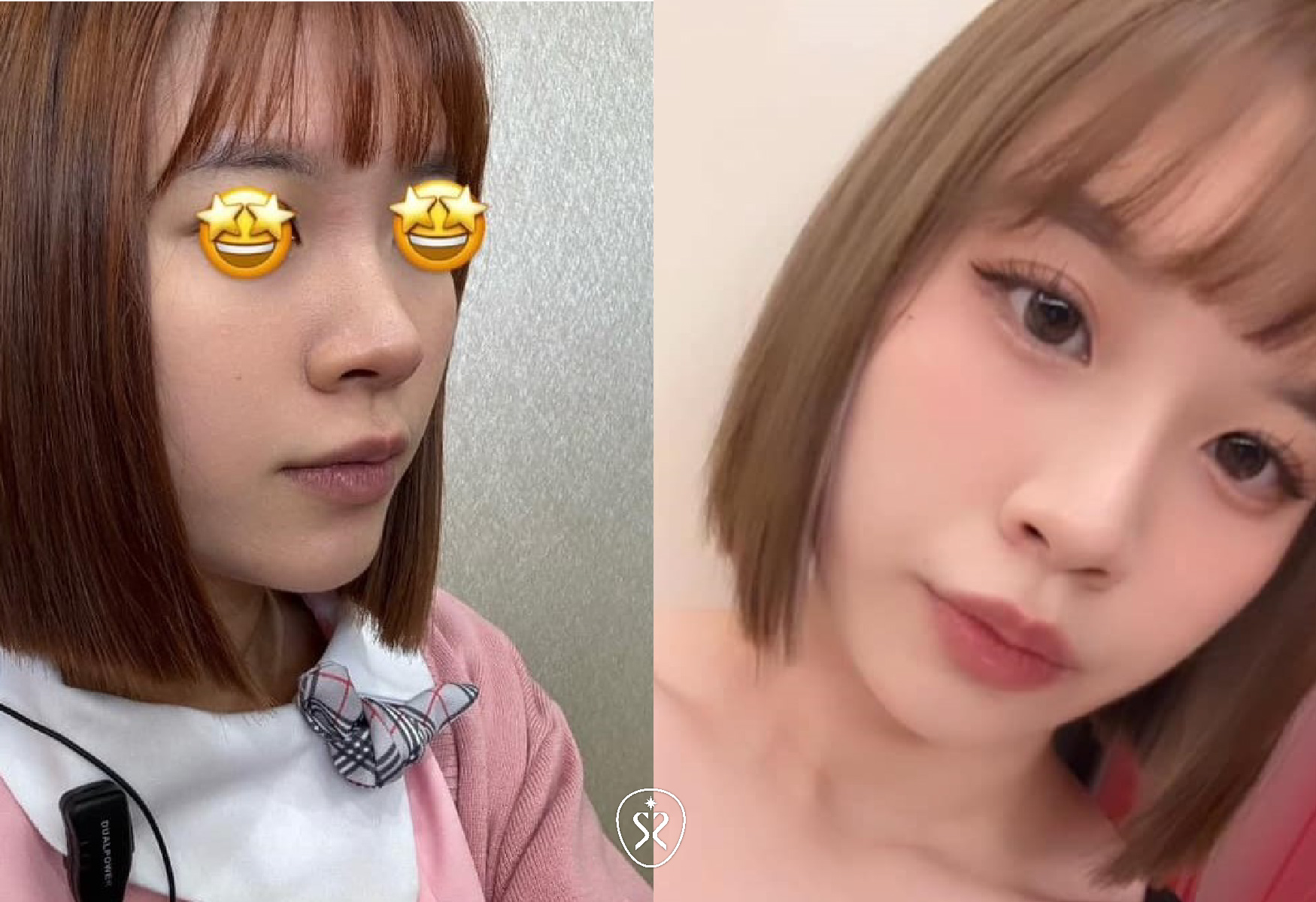 MINT秘特拉提線一體成型PDO可吸收3D立體雙向倒鉤支撐鼻樑鼻頭線條
